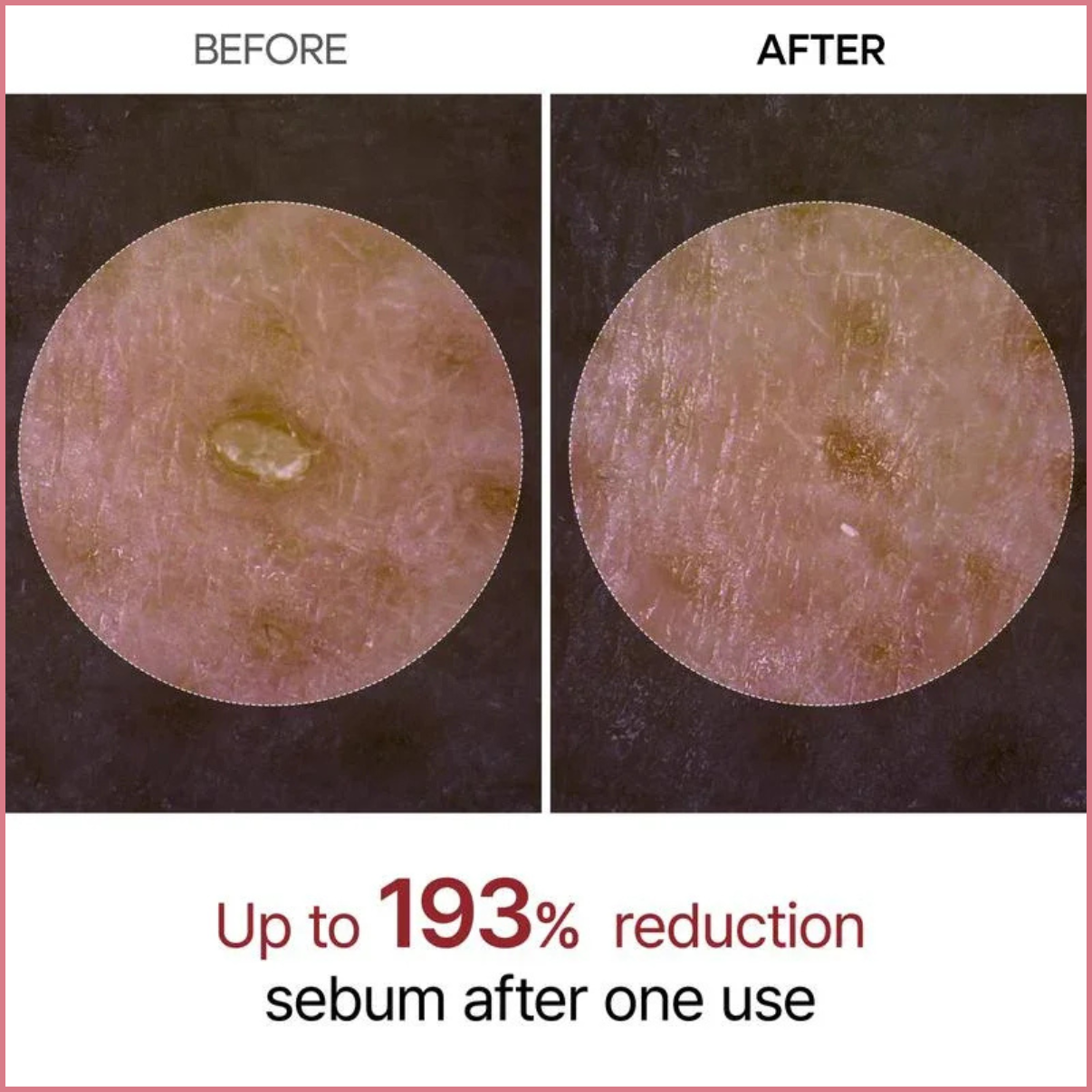 Rice Peel Shot Ampoule™