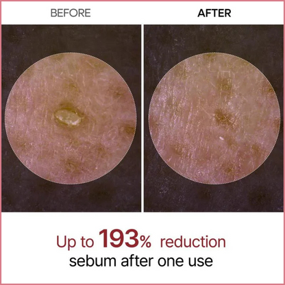 Rice Peel Shot Ampoule™